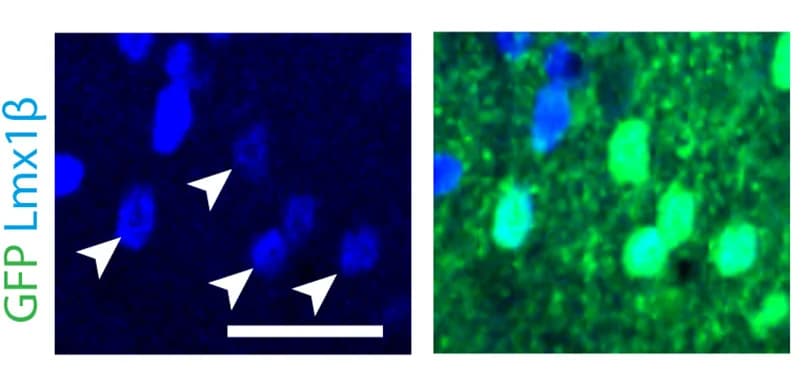 Open access visualization of Microscopy, Immunofluorescence Staining, Spinal Cord, c-MafEX Mice, eGFP+ Neurons