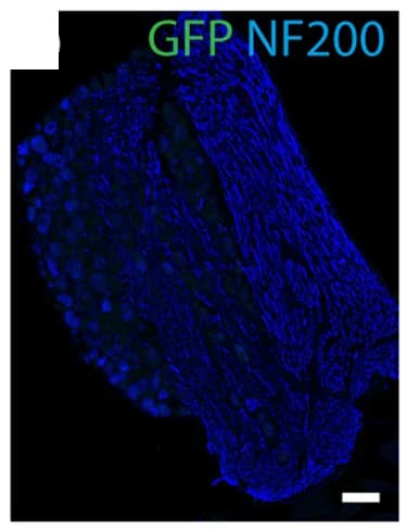 Open access visualization of Microscopy, c-MafIN Neurons, Morphology