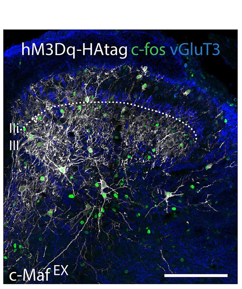 Open access visualization of Microscopy, Spinal Cord, Immunoreactivity, CNO, hM3Dq