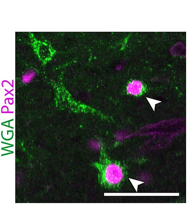 Open access visualization of Microscopy, WGA, Anterograde Tracing, c-MafEX Neurons, Rosa26dstdTom Mice