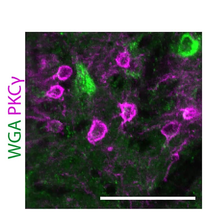 Open access visualization of Microscopy, Immunofluorescence Staining, Lumbar Spinal Cord, WGA, tdTom