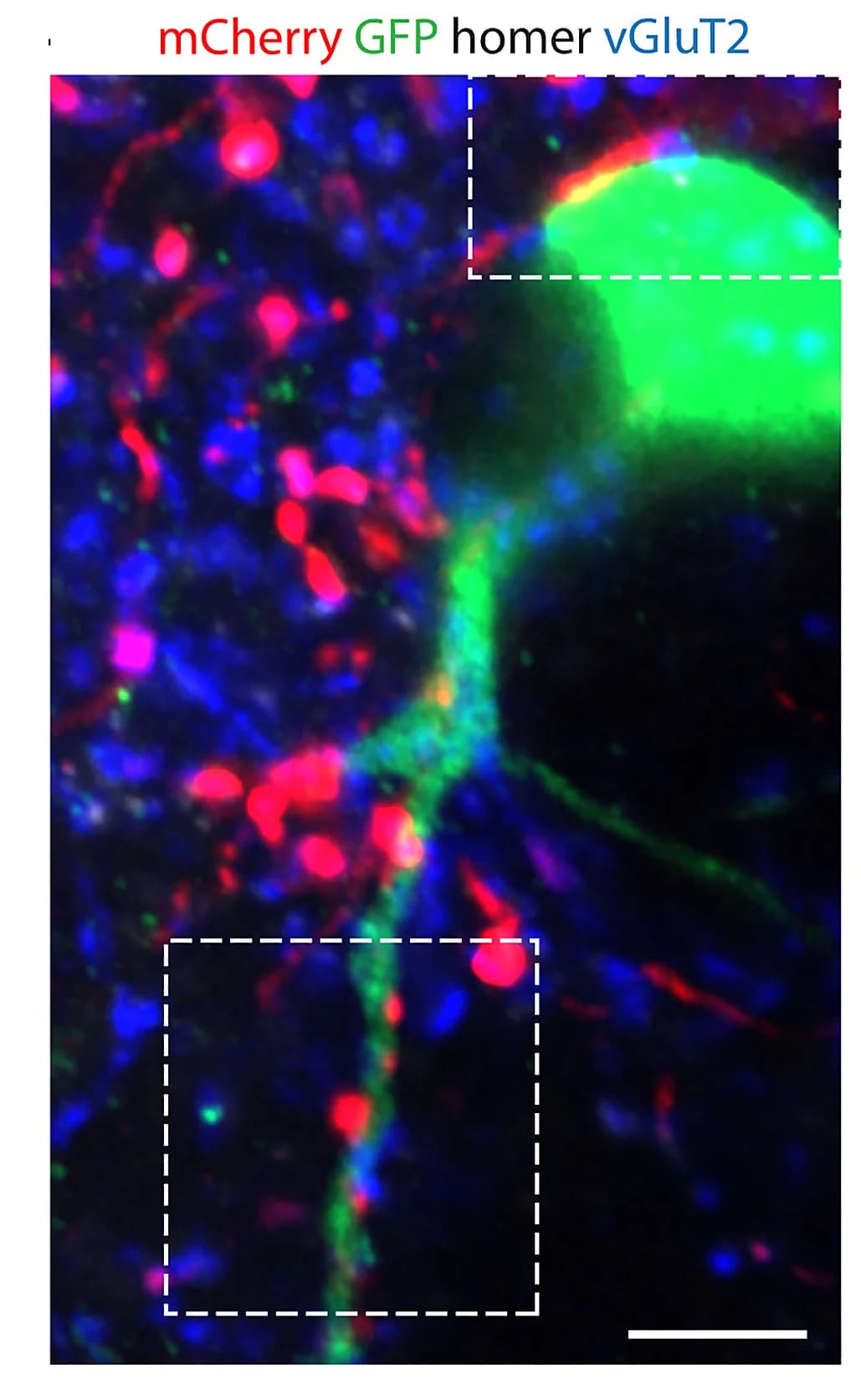 Open access visualization of Microscopy, Co-labeling, eGFP Neuron, mCherry+VGlut2+ Synaptic Terminals, Postsynaptic Marker Homer