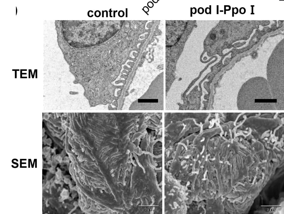 Open access visualization of Microscopy, Photomicrographs, Transmission Electron Microscopy, Scanning Electron Microscopy