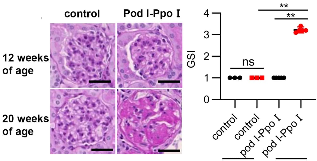 Open access visualization of Scatter Plot, Microscopy, Photomicrographs, Periodic Acid-Schiff Staining, Glomerulosclerosis Index