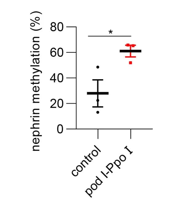 Open access visualization of Error Bars, Methylation-Specific PCR, Nephrin Promoter
