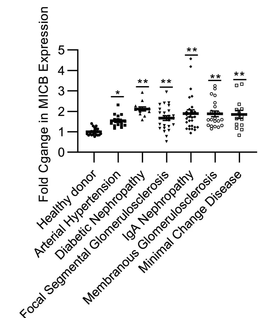 Open access visualization of Scatter Plot, NKG2D Ligand, MICB, Glomeruli, Kidney Diseases