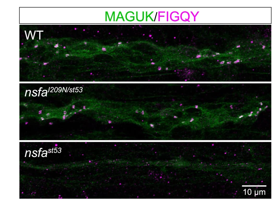 Open access visualization of Microscopy, MBP, AcTub, FIGQY, Antibody Labeling