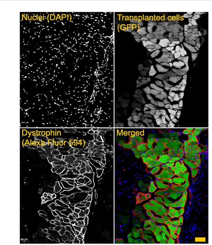 Open access visualization of Microscopy, Dystrophin, Engrafted, PrkdcscidDmdmdxrecipients, Nuclei