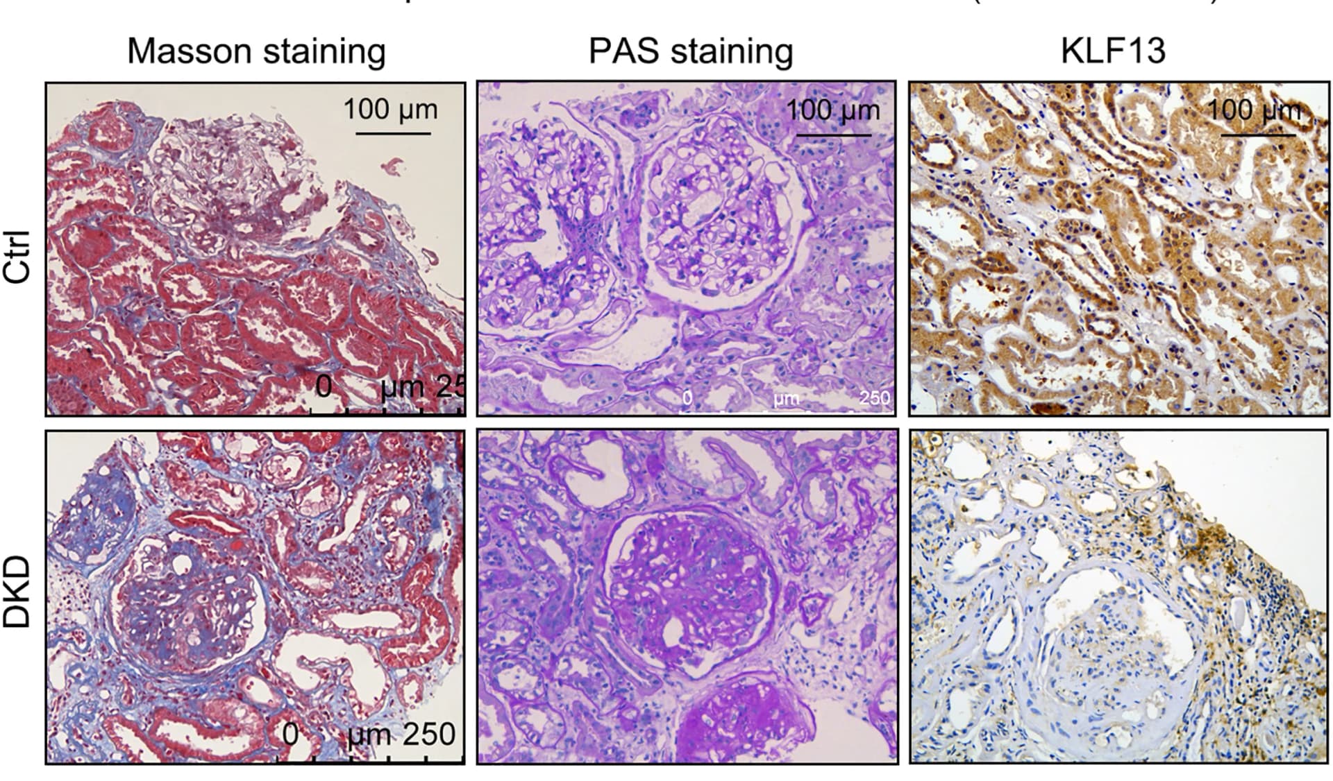 Open access visualization of Microscopy, Masson trichrome staining, KLF13 immunofluorescence staining, Kidney sections, MCD
