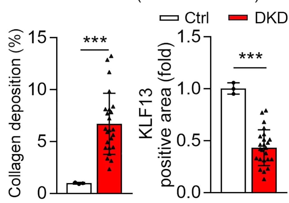 Open access visualization of Bar Plot, Error Bars, Scatter Plot, Quantitative analysis, Masson trichrome staining