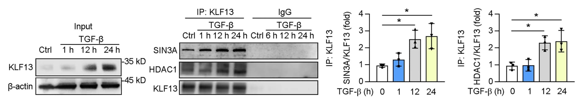 Open access visualization of Bar Plot, Error Bars, Gel, Photo, HK2 Cell Lysates