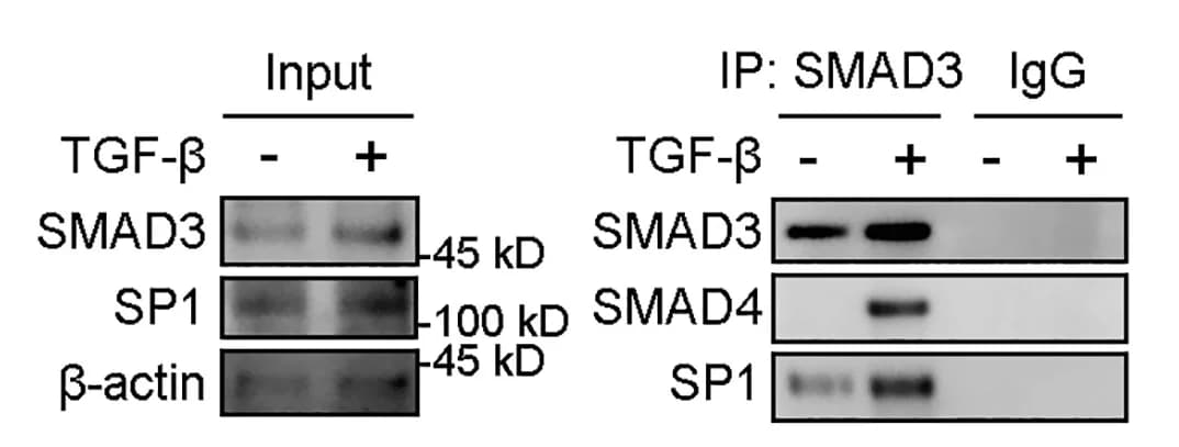 Open access visualization of Gel, Western blot, SMAD3, Immunoprecipitates, HK2 cells