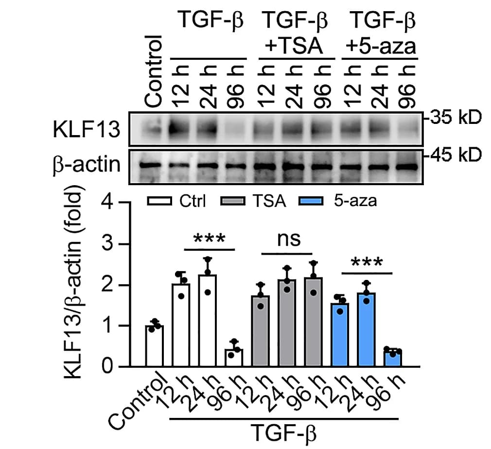 Open access visualization of Bar Plot, Error Bars, Gel, Western Blot, KLF13