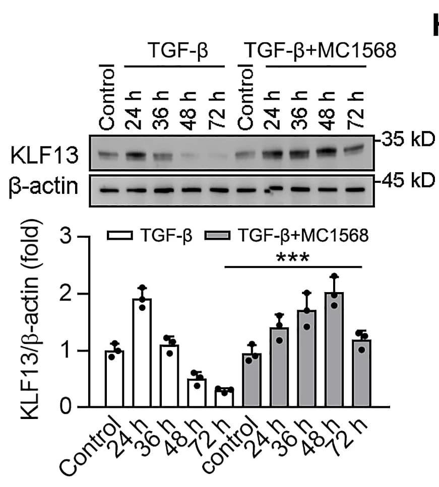 Open access visualization of Bar Plot, Error Bars, Gel, Western Blot, KLF13
