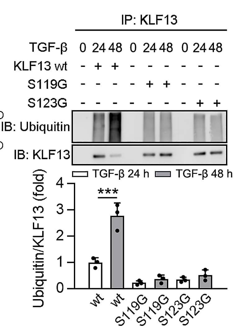Open access visualization of Bar Plot, Error Bars, Gel, Western Blot, Ubiquitination