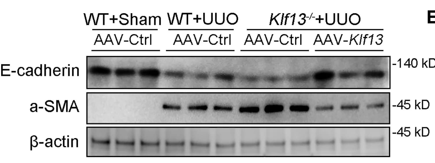 Open access visualization of Gel, Western Blot, E-cadherin, Alpha-SMA, Beta-actin