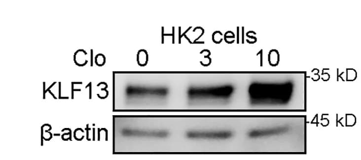 Open access visualization of Gel, Western blot, KLF13, Beta-actin