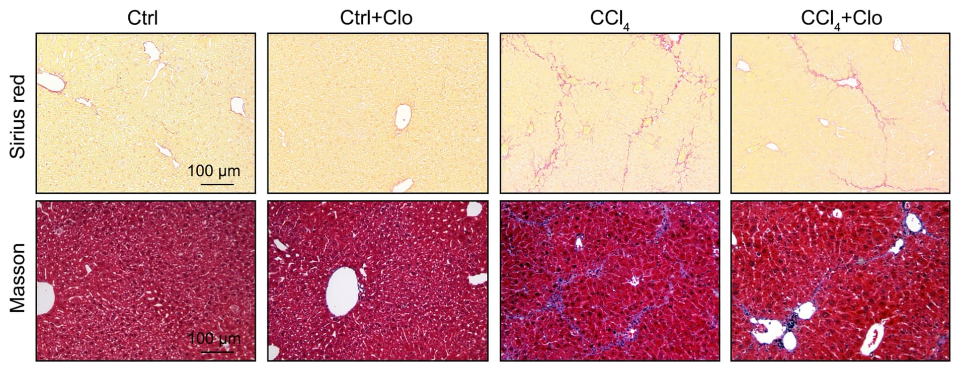 Open access visualization of Microscopy, Sirius red staining, Masson trichrome staining, Kidneys, Mice