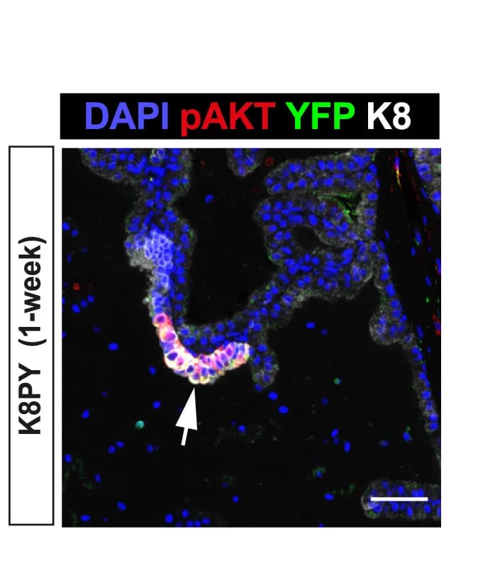 Open access visualization of Microscopy, Immunofluorescence, Murine Prostate, Tamoxifen Treatment, Keratin 8