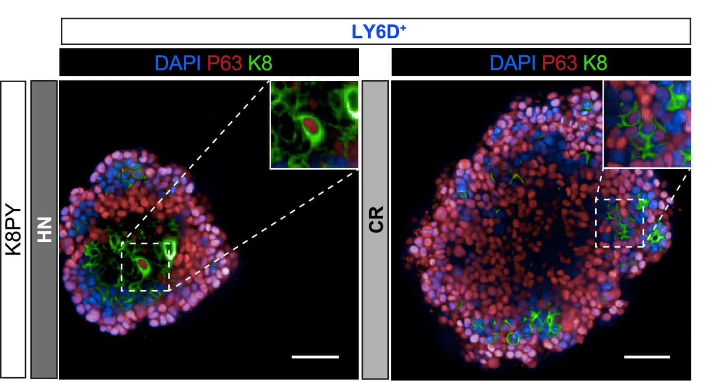 Open access visualization of Microscopy, IF, Prostate Organoids, LY6D Luminal Cells, Keratin 8