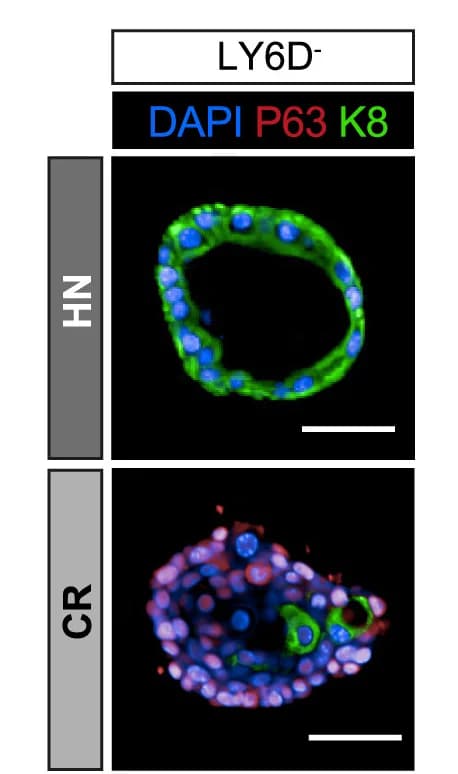 Open access visualization of Microscopy, IF, Prostate Organoids, LY6D Luminal Cells, Keratin 8