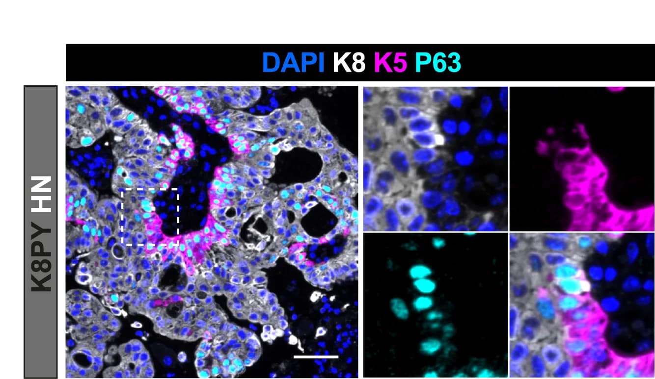 Open access visualization of Microscopy, IF, K8PY Prostates, Tamoxifen, Tumor Areas