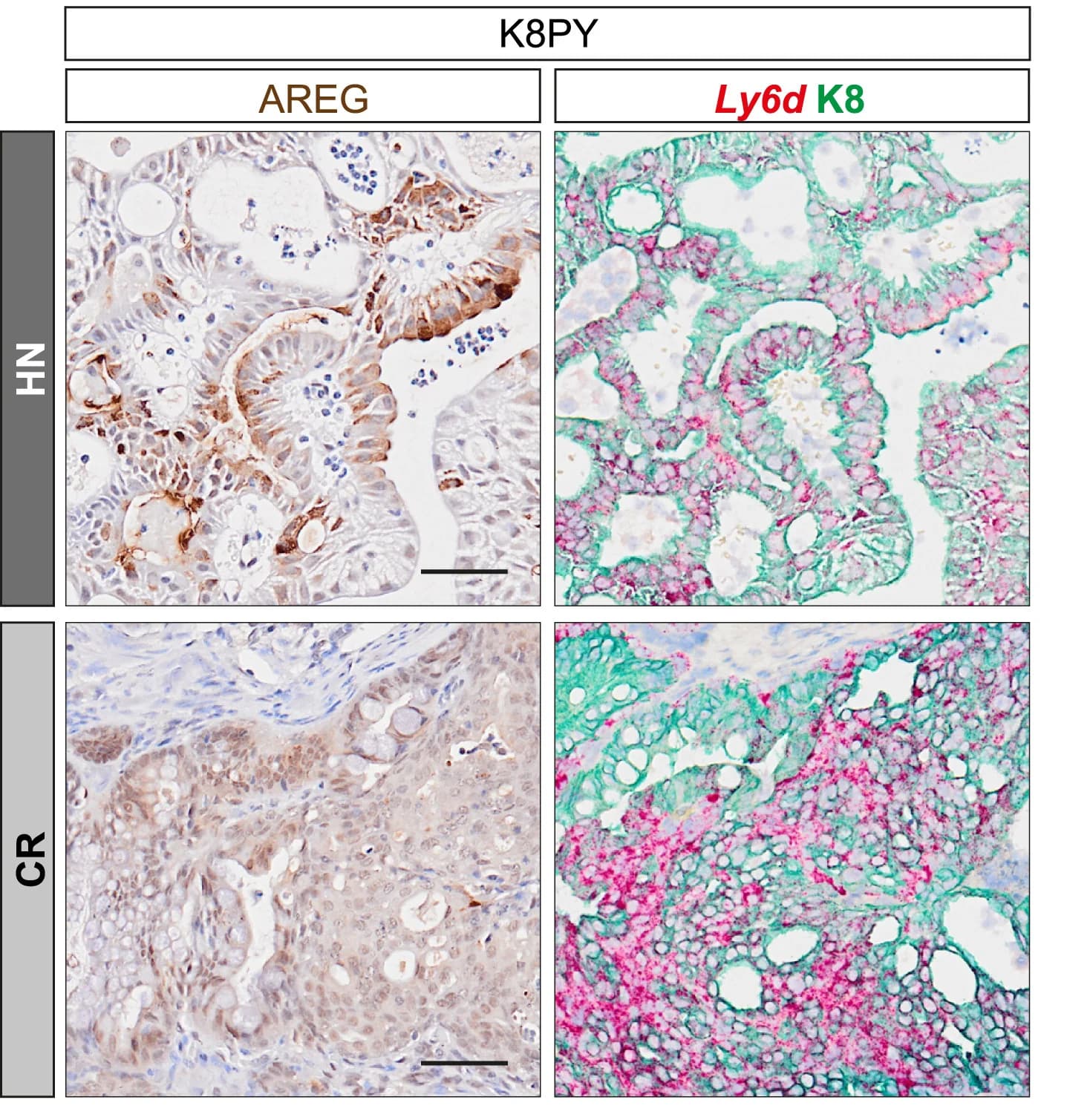 Open access visualization of Microscopy, AREG expression, K8PY prostates, Ly6d (RNA-ISH), Prostate