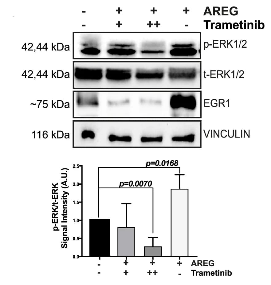 Open access visualization of Bar Plot, Error Bars, Gel, AREG-Stimulated DVL3 Cells, Trametinib Treatment