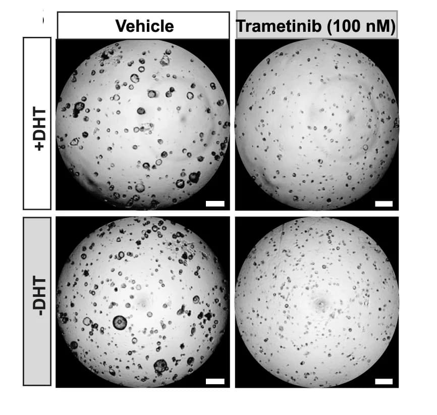 Open access visualization of Microscopy, Organotypic 3D Cultures, DVL3 Prostate Cells, Trametinib Treatment, Androgen Stimulation