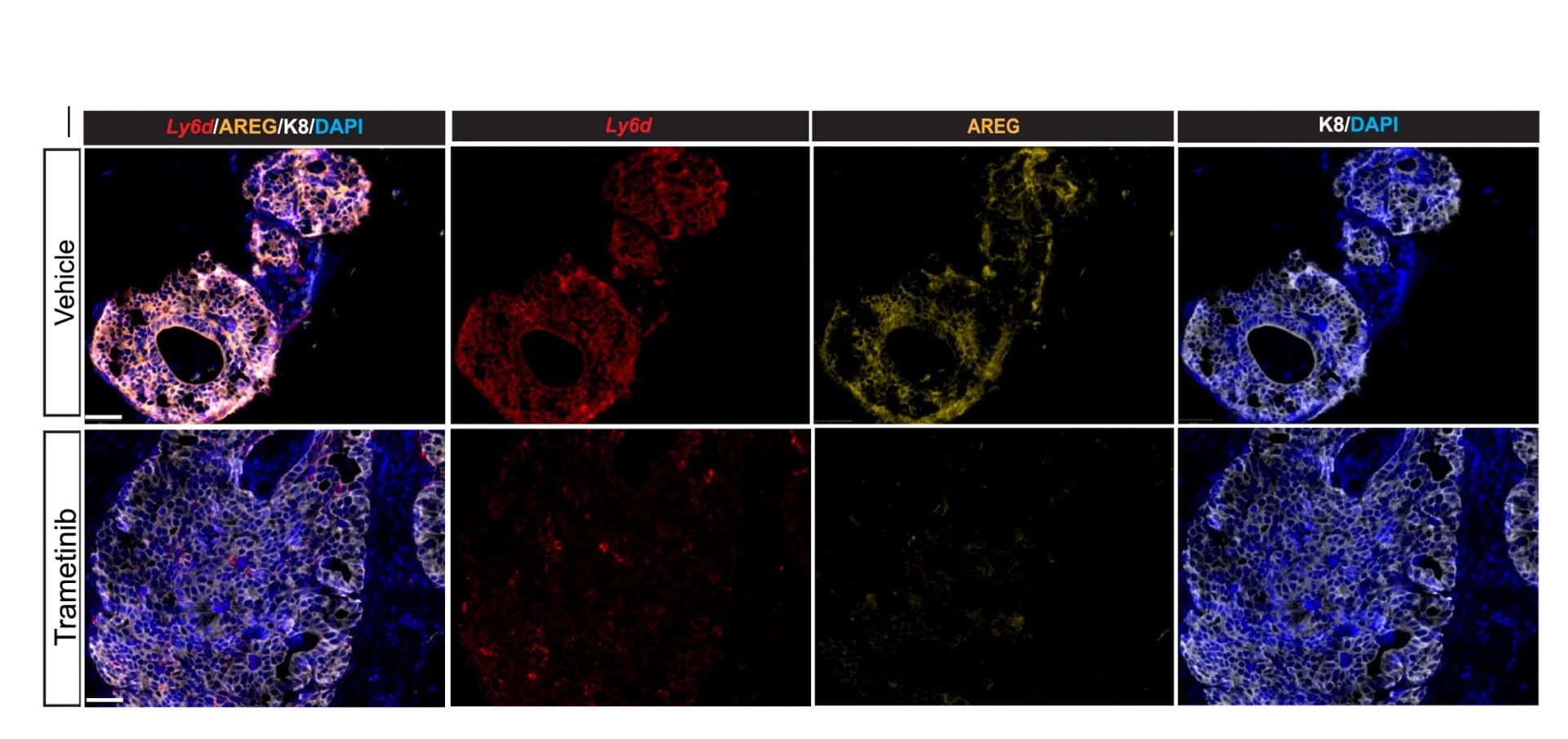 Open access visualization of Microscopy, AREG Expression, Mouse Prostates, K8YP Mice, Trametinib Treatment