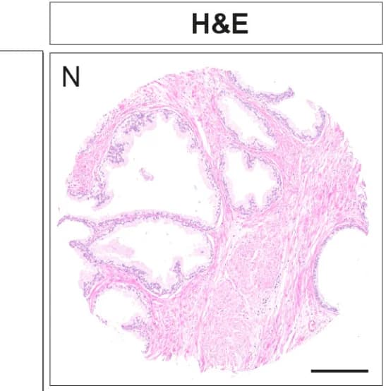 Open access visualization of Microscopy, H&E, IF, Histopathology, LY6D