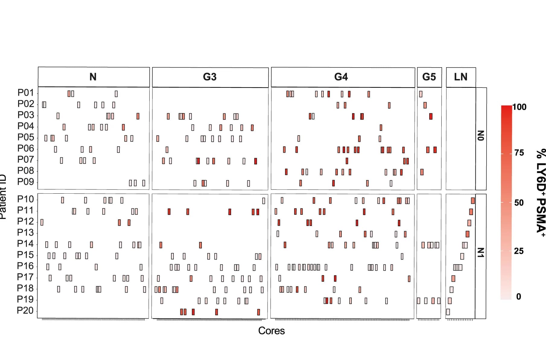 Open access visualization of Heatmap, LY6D, Prostate Epithelium, CK, PSMA