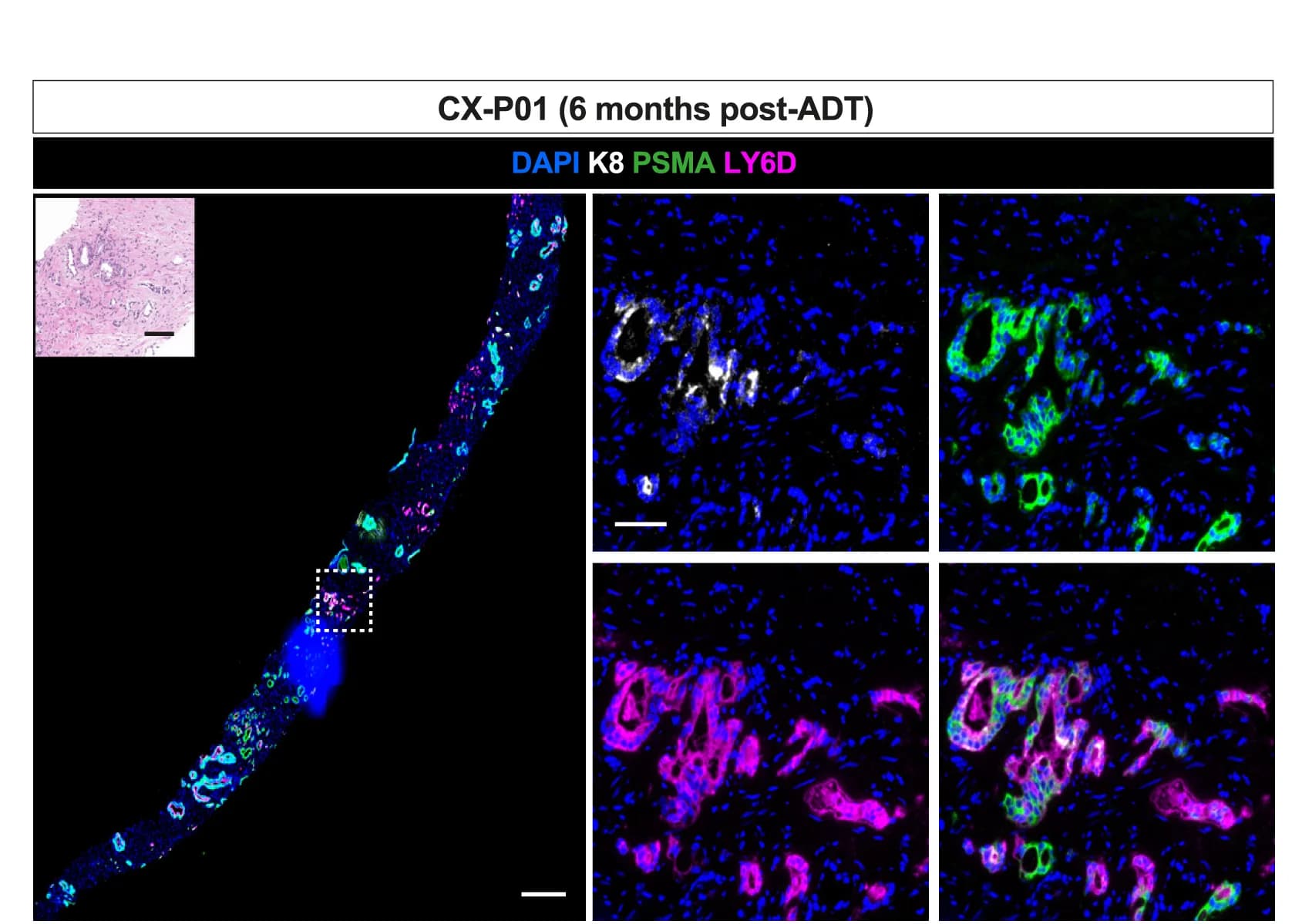 Open access visualization of Microscopy, H&E, IF, Needle Core Biopsies, PCa