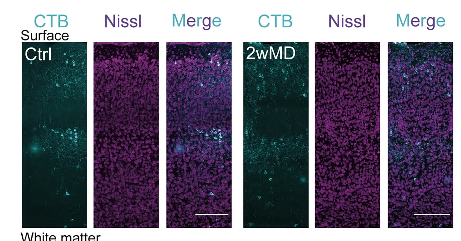 Open access visualization of Microscopy, Retrogradely Labeled Neurons, S1bf, Control Mice, 2wMD Mice