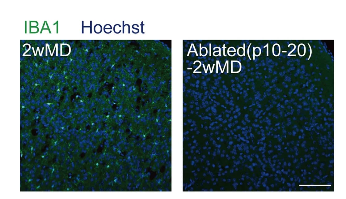Open access visualization of Microscopy, Immunohistology, Microglia Density, Microglia, IBA1