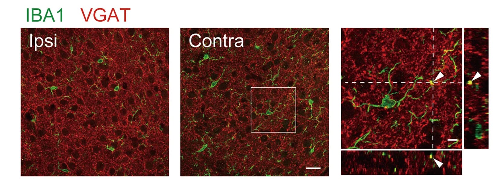 Open access visualization of Microscopy, IBA1, VGAT, VGlut, Synapse Markers