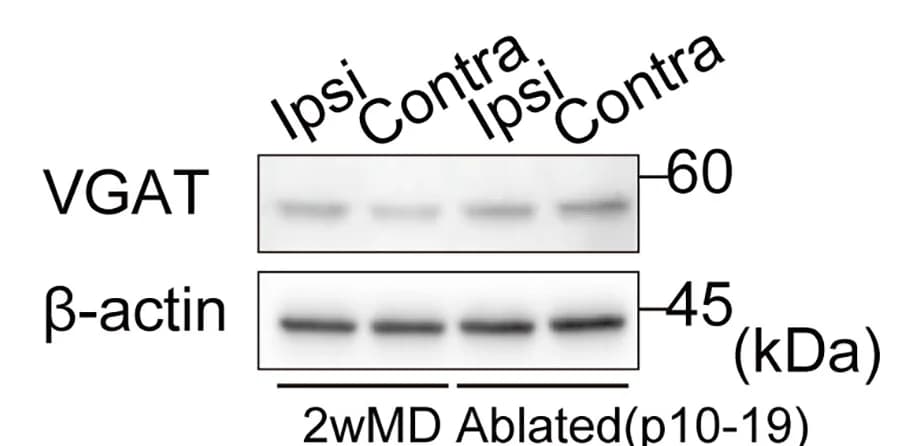 Open access visualization of Gel, Western Blots, VGAT, VGlut, Protein Expression