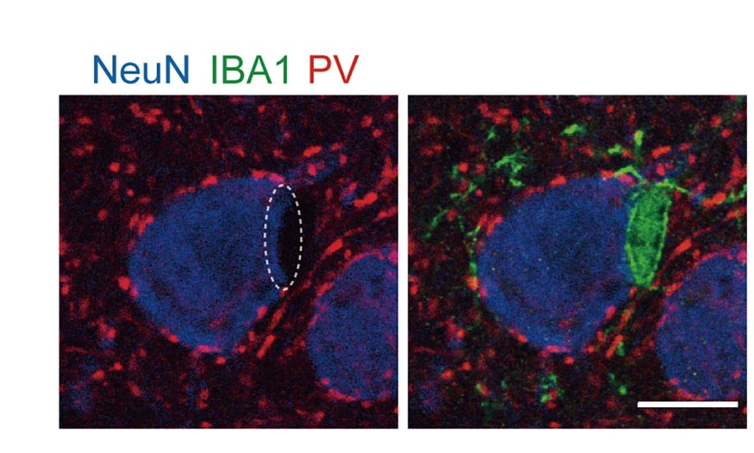 Open access visualization of Microscopy, Microglia, Excitatory Neuron, Inhibitory Terminals