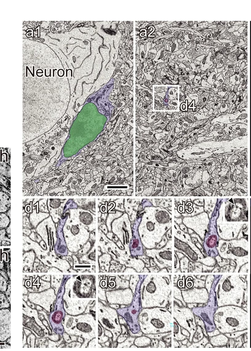 Open access visualization of Microscopy, Phagocytosis, Presynaptic Elements, Microglia, Electron Microscopic Images
