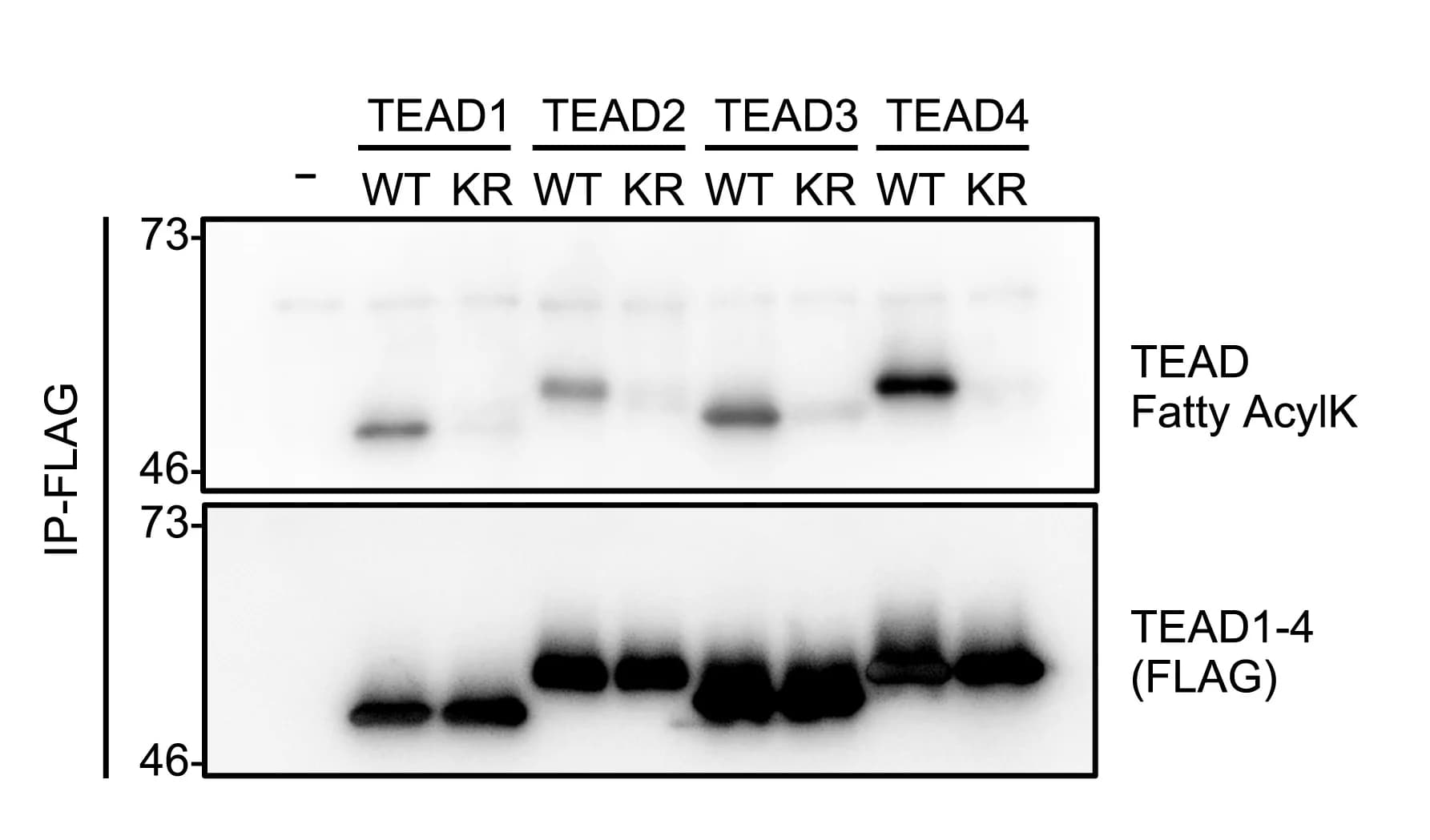 Open access visualization of Gel, Lysine Fatty-Acylated TEADs, Anti-Fatty-Acyl-TEAD Antibody, HEK293T Cells, FLAG-tagged TEAD1-4