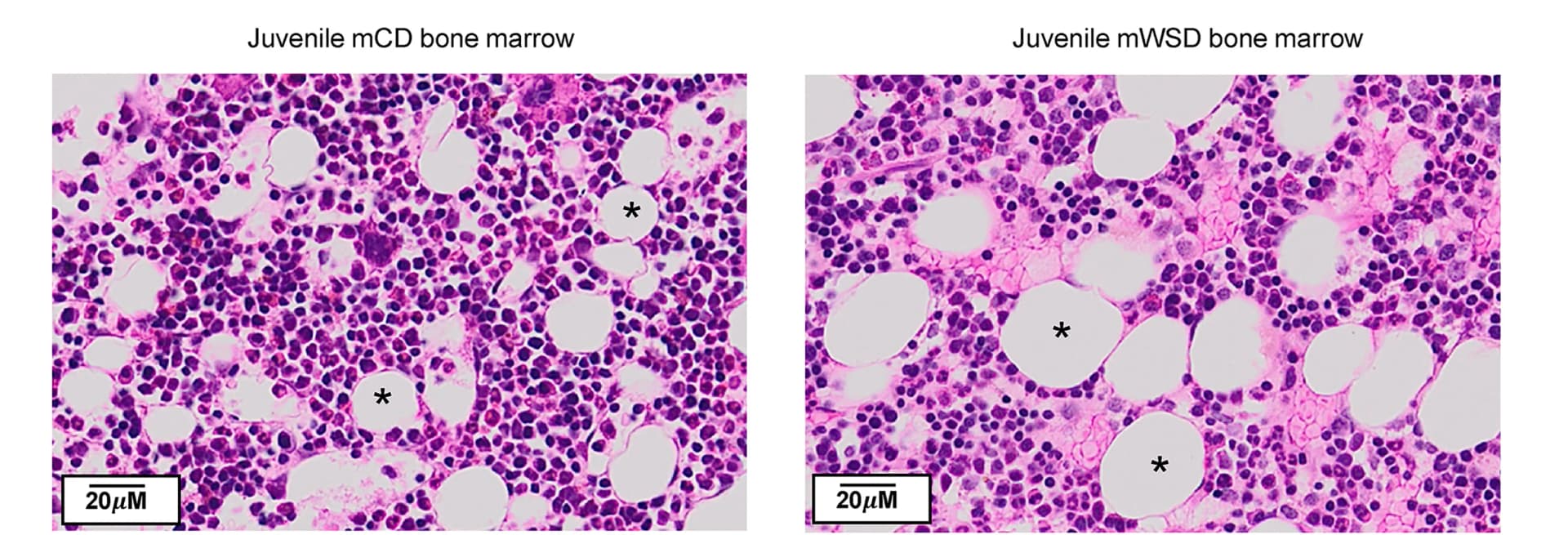 Open access visualization of Microscopy, Juvenile Bone Marrow, Adipocytes