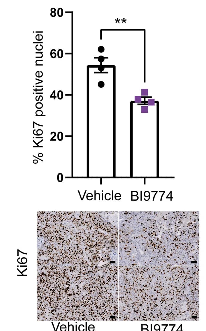 Open access visualization of Bar Plot, Error Bars, Microscopy, Ki-67-Positive Cells, Xenograft Tumors