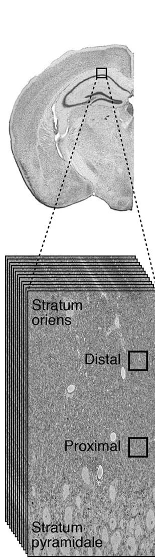 Open access visualization of Microscopy, Hippocampus, Stratum Oriens, Stratum Pyramidale, CA1 Pyramidal Neurons