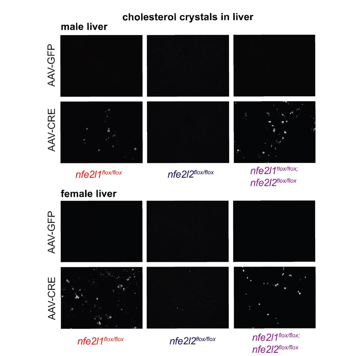 Open access visualization of Microscopy, Cholesterol Crystals, Liver Sections