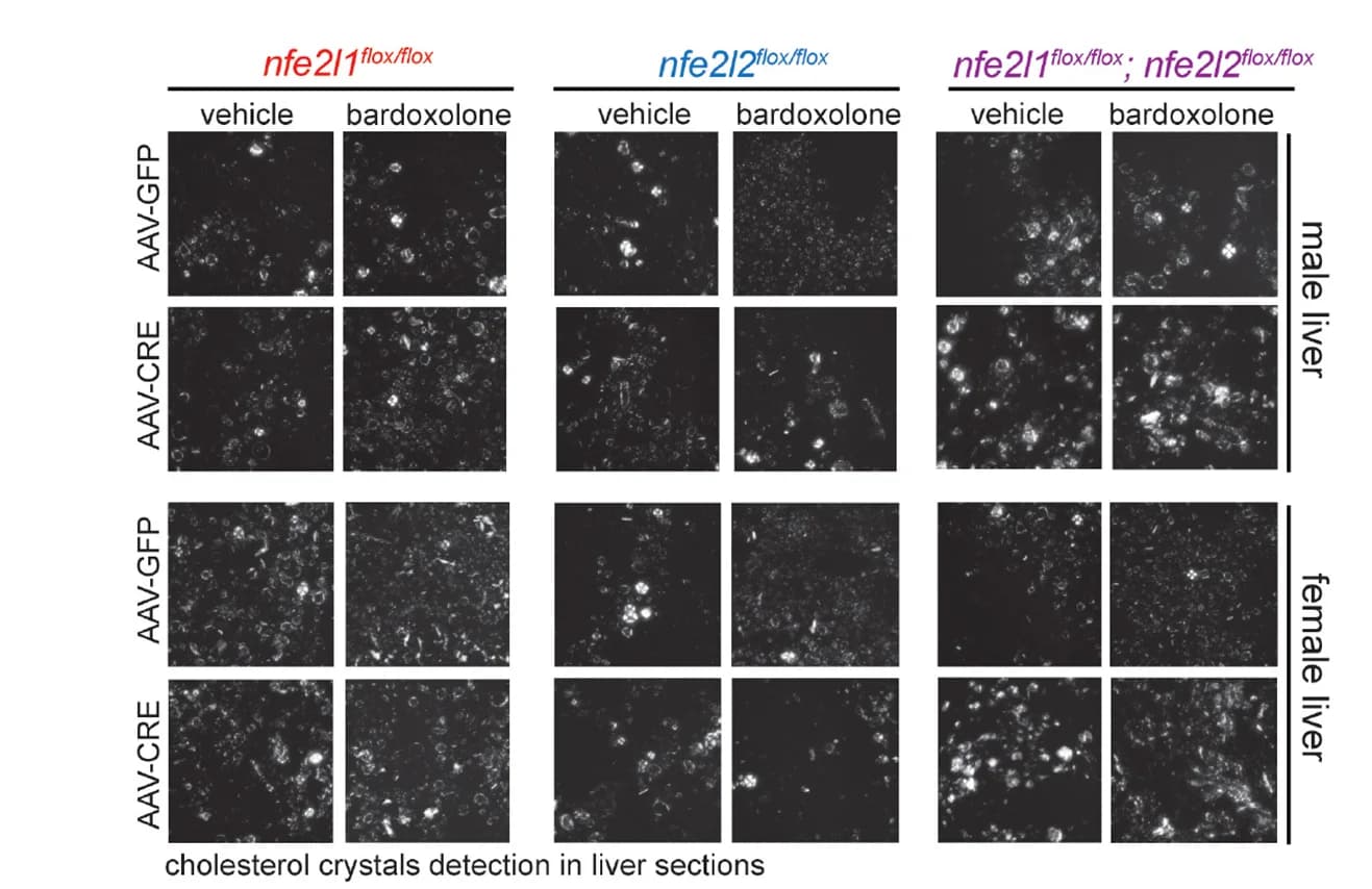 Open access visualization of Microscopy, Cholesterol Crystals, Liver Sections