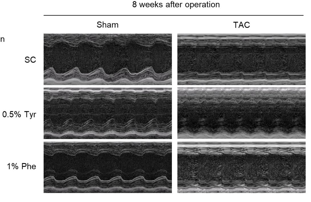 Open access visualization of Microscopy, Echocardiogram, M-mode Echocardiogram
