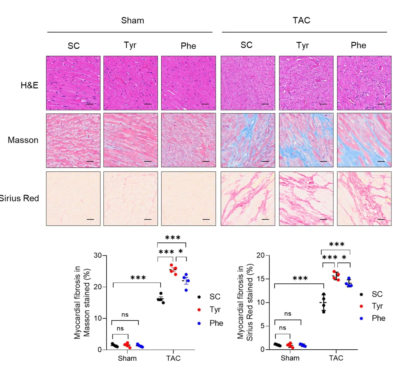 Open access visualization of Scatter Plot, Microscopy, H&E Staining, Masson Trichrome Staining, Sirius Red Staining