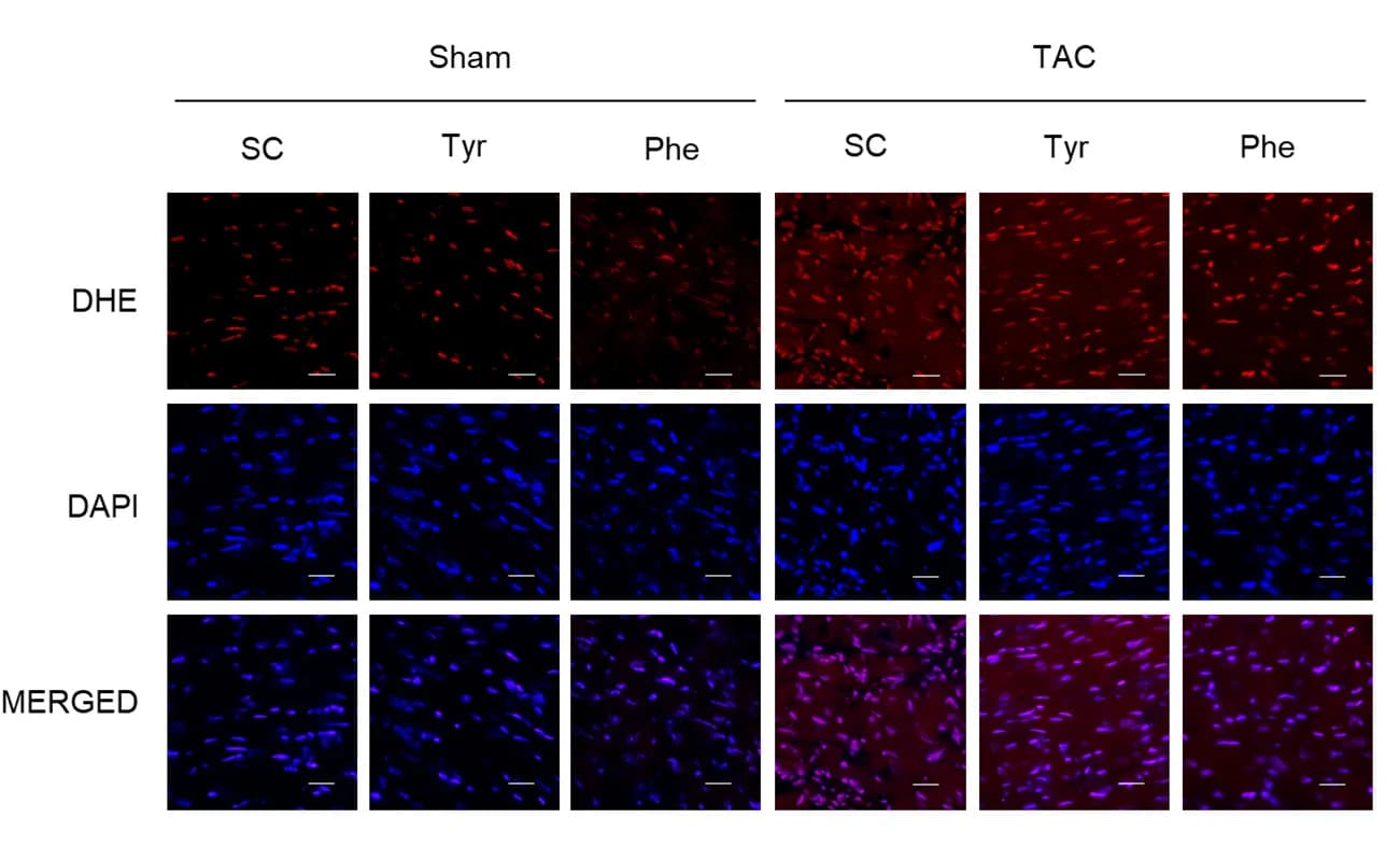 Open access visualization of Microscopy, Dihydroethidium Staining, DHE Staining, Heart Tissues