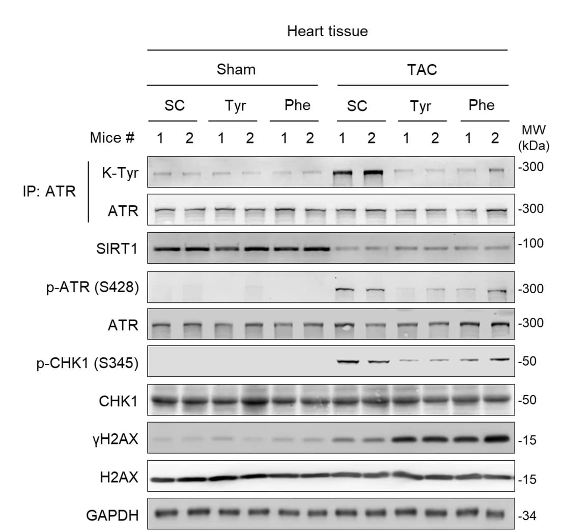 Open access visualization of Gel, Western Blot, ATR, p-ATR, CHK1