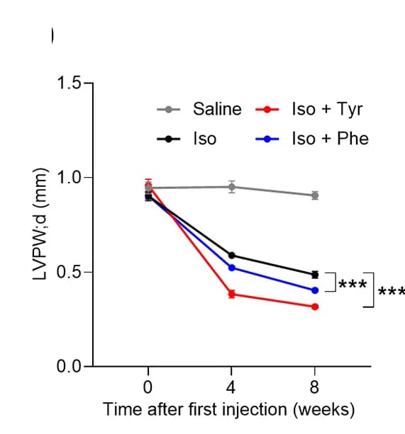 Open access visualization of Line Plot, Error Bars, Echocardiography, Heart Function, LVPWd